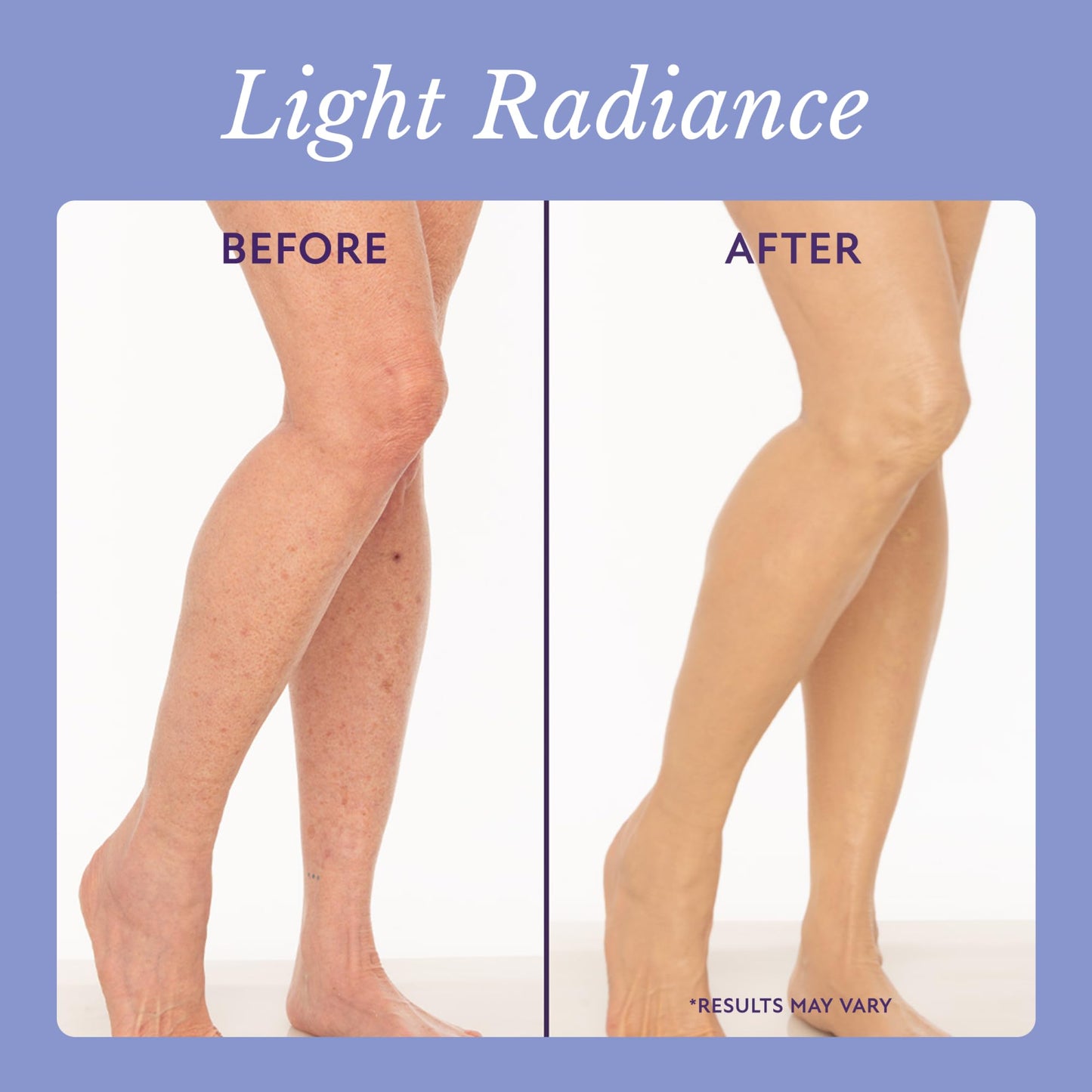 Body Coverage Perfector for Skin That Speaks of Confidence